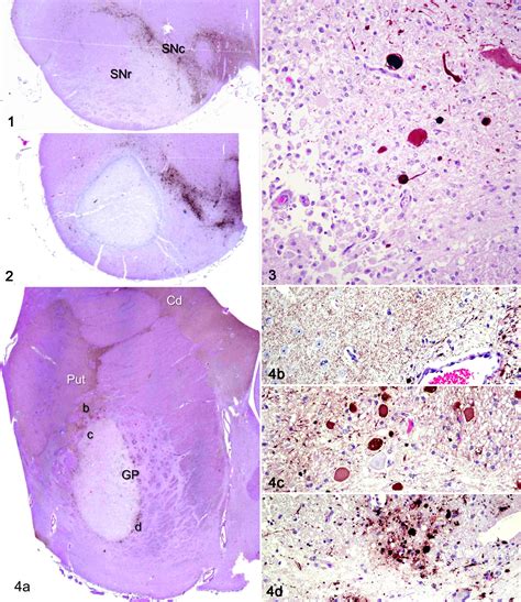 Substantia Nigra Histology