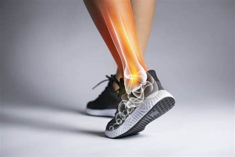 Deltoid ligament sprain treatment at CARESPACE in Kitchener Waterloo