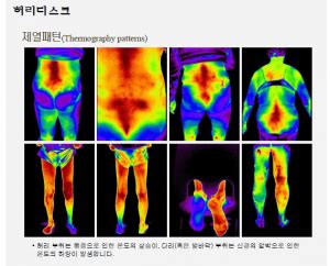 첨단 체열진단기-DITI 도입! (대학병원급 첨단 의료장비) – 허리편한병원