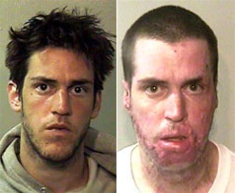 Shocking before and after pics of crystal meth junkies | Weird pictures and photo galleries ...