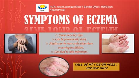 SYMPTOMS OF ECZEMA | Eczema symptoms, Eczema causes, Eczema treatment