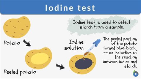 Iodine test - Definition and Examples - Biology Online Dictionary