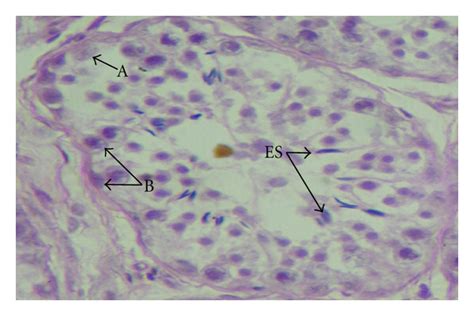 Photomicrograph showing type-A spermatogonia (A), type-B spermatogonia ...