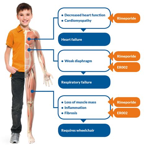 Muscular Dystrophy