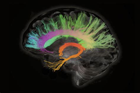 Brain Monitoring Could Prevent Most Neurological and Psychiatric Illnesses - Scientific American