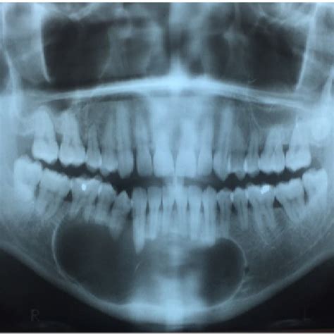 Initial Orthopantomogram. | Download Scientific Diagram