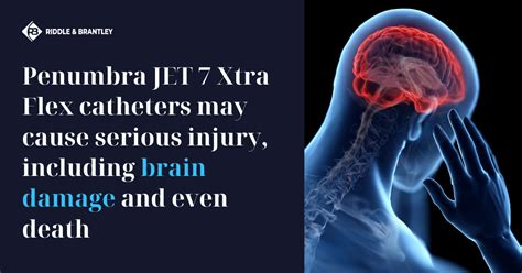 Penumbra Brain Damage | Penumbra JET 7 Xtra Flex Catheter Injury