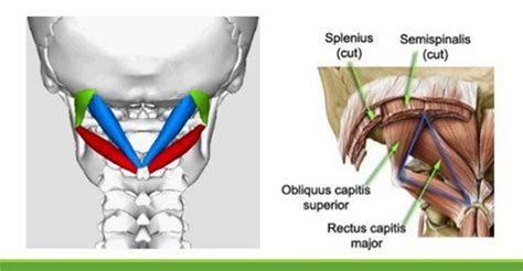 Suboccipital Triangle: Overview, Boundries & Contents » How To Relief ...