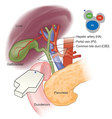 Hepatic triad visualized with ultrasound | Battista Illustration