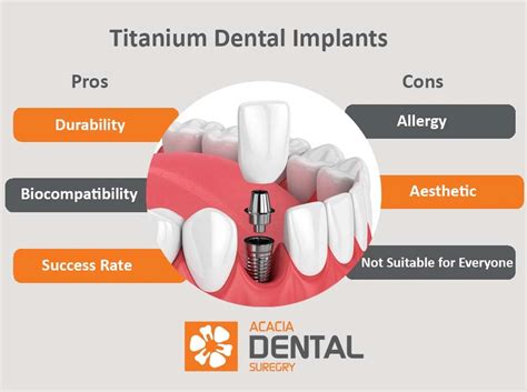 Titanium Dental Implants: Advantages and Side Effects — Acacia Dental