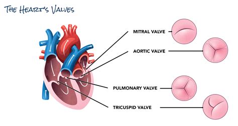 Heart Valve Disease | SCAI - Seconds Count