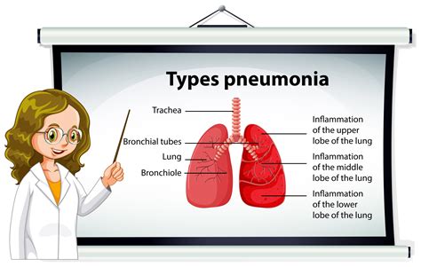 Bronchial Pneumonia