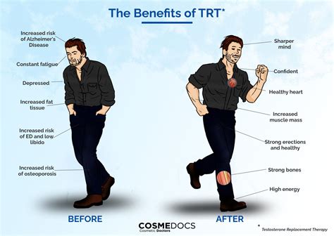 TRT UK- A Simple Solution To Change Men's Lives