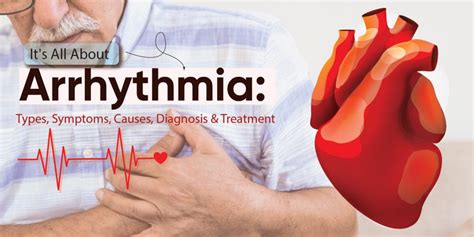 Arrhythmia: Symptoms, Causes, Types, Diagnosis & Treatment