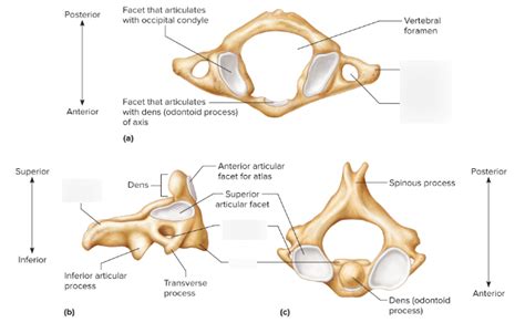 Atlas vs Axis Diagram | Quizlet