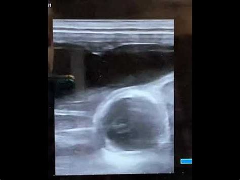 5 month pregnant horse ultrasound - YouTube