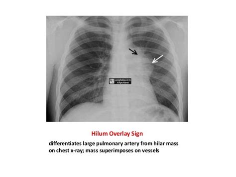 Dr.laith notes about common radiological signs