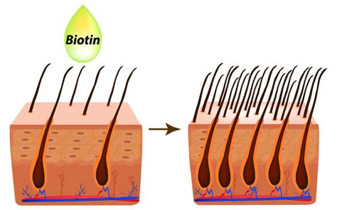 Does Biotin Boost Your Hair Growth? – SkinKraft