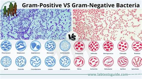 Gram Positive VS Gram Negative Bacteria: Differences and Similarities | Lab Tests Guide