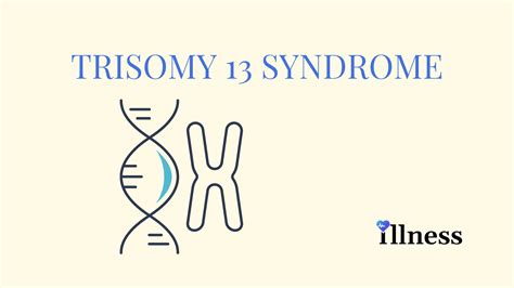 Trisomy 13 Syndrome : Overview, Causes, Symptoms, Treatment - illness.com