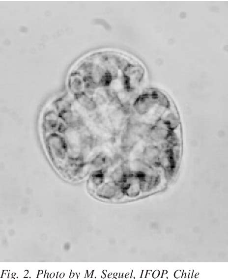 Figure 1 from A new species of Gymnodinium that caused the 1998 summer ...