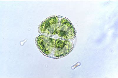 Cosmarium sp. - Cosmarium - Charophyta (Green algae) - Algae - Microbiology - Plant histology ...