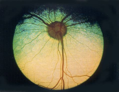 Progressive Retinal Atrophy - Australian Shepherd Health & Genetics Institute