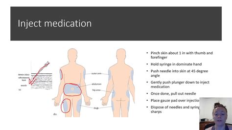 Trans health Hormone Subcutaneous Injection Teaching video - YouTube