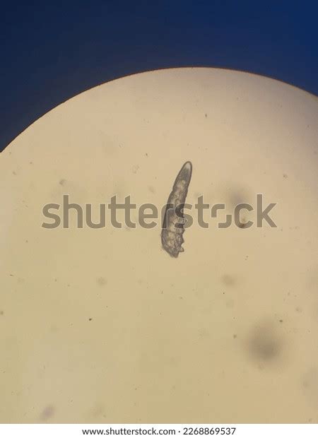 Eyelash Mite Demodex Parasite Eye Stock Photo 2268869537 | Shutterstock