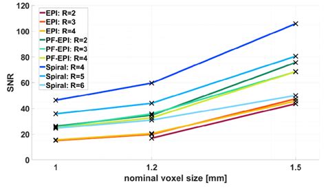 SNR calculated from in-vivo scans. The SNR was calculated within a ...