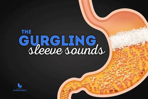 The Gurgling Sleeve Sounds - Gastric Sleeve Mexico