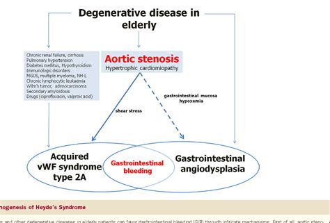 Angiodysplasia of the colon as related to Aortic valve stenosis - Pictures