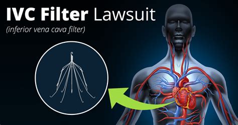 IVC Filter Complication Lawsuit | Attorney Jonathan Kline P.A.