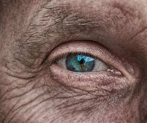 Cataracts surgery – when do I need to have it? - London OC