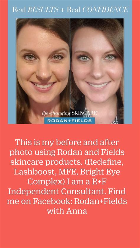 Pin on Healthy Skincare: Rodan + Fields