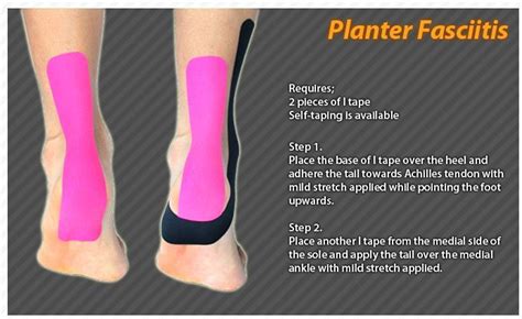 52357ca883598de15b9468916109f8ef.jpg 694×426 pixels | Kinesiology taping, Plantar fasciitis ...