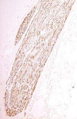 Myelin Protein Zero Antibody (NB100-1607): Novus Biologicals