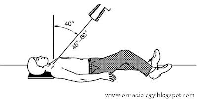 ON - RADIOLOGY: What is Serendipity View or Rockwood view? And how to get?