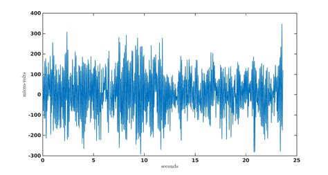 Factors that Impact Power Spectral Density Estimation - Sapien Labs | Neuroscience | Human Brain ...