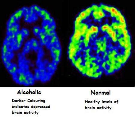 The Neurotransmitter - The Nervous System and Alcohol