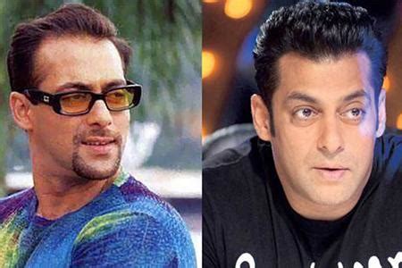 Salman Khan Hair Transplantation | Salman Hair Transplant Cost In India ...