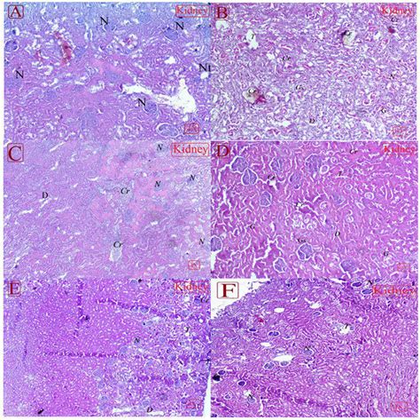 Photomicrographs of kidney sections at 4X and 10X magnifications where ...