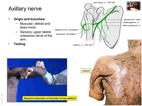 Applied anatomy axillary nerve injury