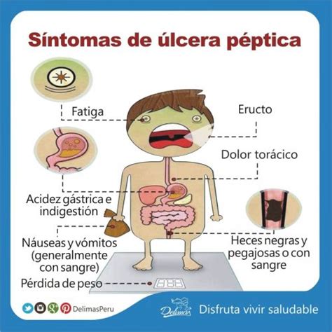 Descubre los síntomas de la úlcera péptica – Blog Vive Sano