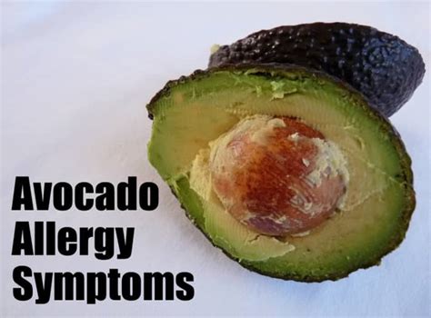 Avocado Allergy Symptoms - YouMeMindBody