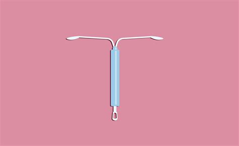 The Most Common Mirena IUD Side Effects – IUD Birth Control Risks