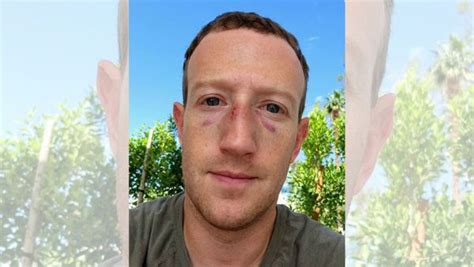 Is This Mark Zuckerberg With Injuries After Elon Musk 'Surprised' Him ...