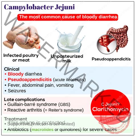 Campylobacter jejuni - Medicine Keys for MRCPs