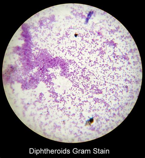 Diphtheroids Gram Stain | Flickr - Photo Sharing!