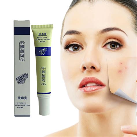 QinY'G 20ML Professional Acne Scar Treatment Pock Pimple Effective ...